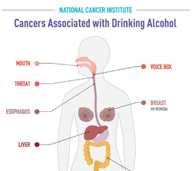 Cancers Associated with Drinking Alcohol